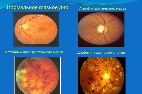 Кракен ссылка настоящая